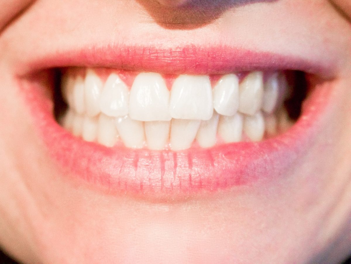 Aktualna technologia stosowana w salonach stomatologii estetycznej być może spowodować, że odzyskamy prześliczny uśmiech.